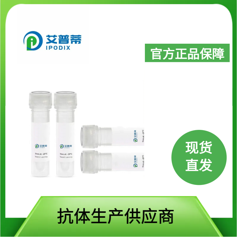 SLC25A12抗体；SLC25A12 antibody  艾普蒂生物              