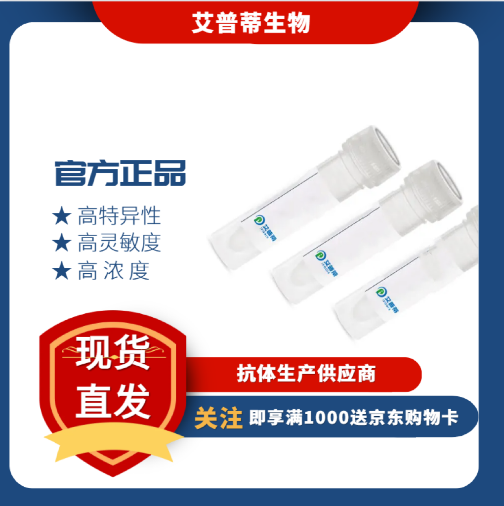 TACC1蛋白抗体；TACC1 antibody  艾普蒂生物     