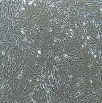 急性T淋巴细胞白血病细胞TALL104