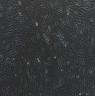 人神经胶质瘤细胞LN18