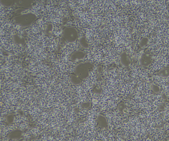 4T1.2小鼠乳腺癌细胞骨转移模型