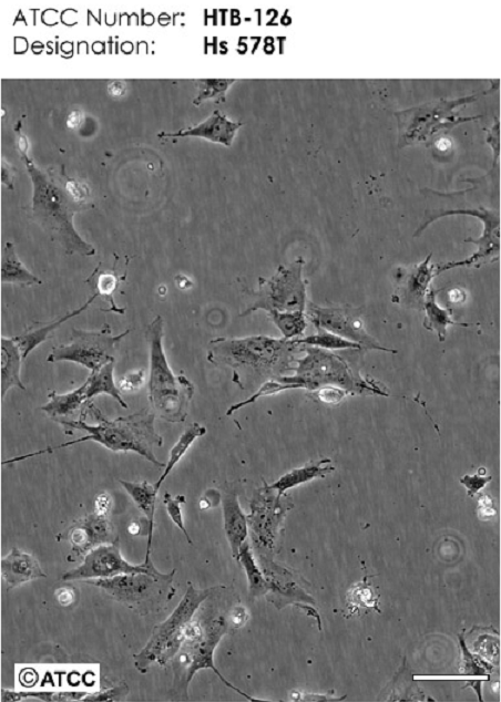 荧光素酶标记的人食管鳞癌细胞KYSE-150/LUC
