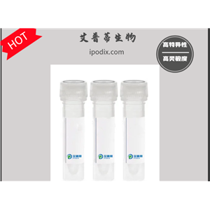 OPTN抗体； OPTN antibody 艾普蒂生物        