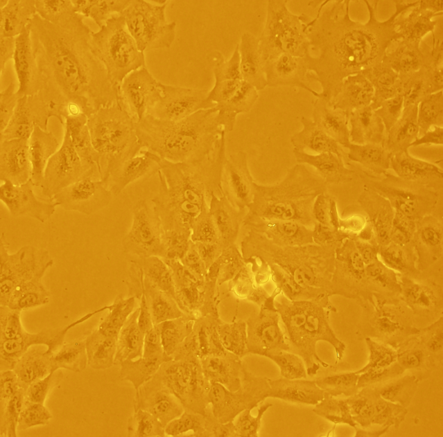 脾细胞骨髓瘤细胞融合细胞TE4