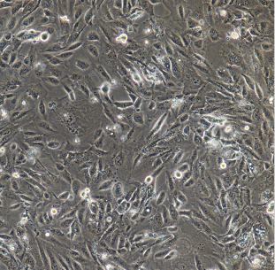 人肺癌细胞(淋巴结转移)NCI-H292/LUC-E/GFP