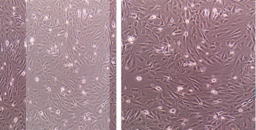 MKN-45-e/GFP/LUC人胃癌细胞-绿色荧光蛋白-荧光素酶标记