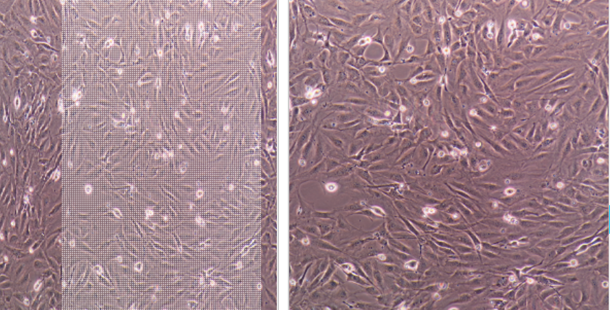 大鼠胰岛素瘤细胞RIN-5F