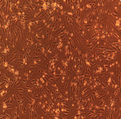 人肾透明细胞腺癌细胞786-0