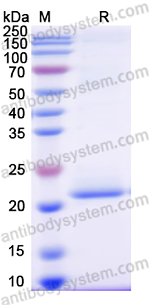 Recombinant Human FGF21 Protein, C-His