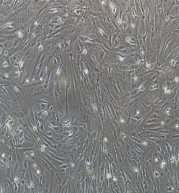 人乳腺癌细胞SUM52PE