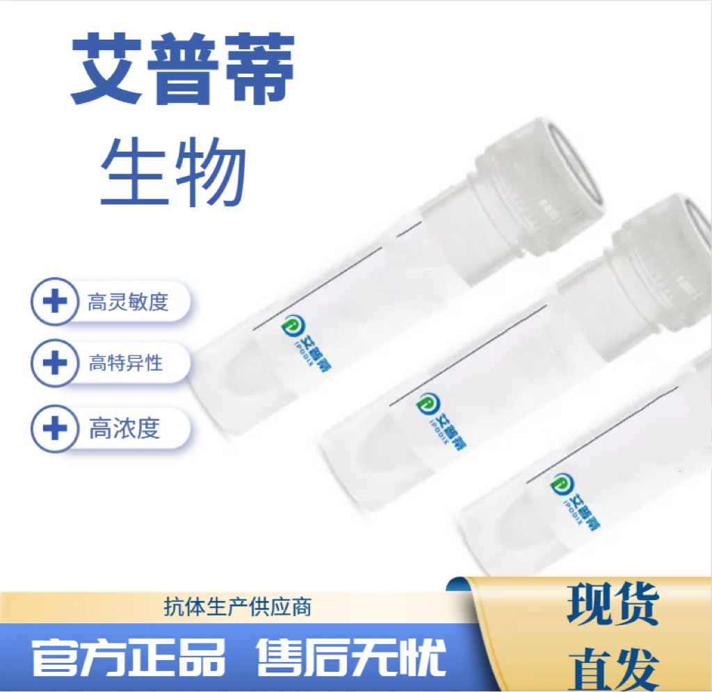 NEK1抗体；NEK1 antibody  艾普蒂生物
