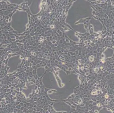 SBC-2人小细胞肺癌