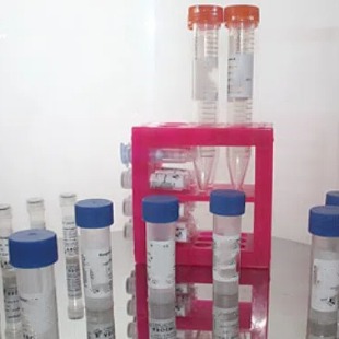 NLRP4抗体；NLRP4 antibody 艾普蒂生物    