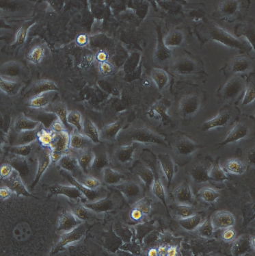 HuFACs-11羊水间充质干细胞