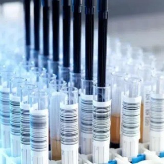 TMPRSS11F抗体；TMPRSS11F antibody  艾普蒂生物