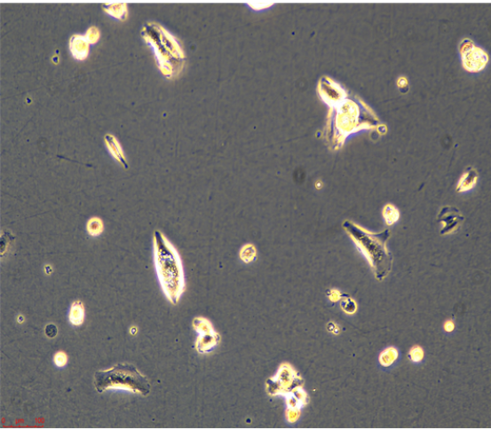 人胚胎横纹肌肉瘤细胞A204，ATCC来源