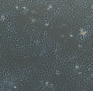 人脑髓母细胞瘤细胞D341Med，ATCC来源