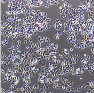 人子宫内膜癌细胞RL952，ATCC来源