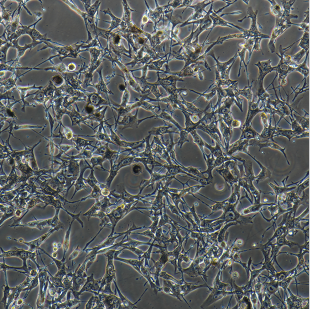 人舌鳞癌细胞SCC25，ATCC来源