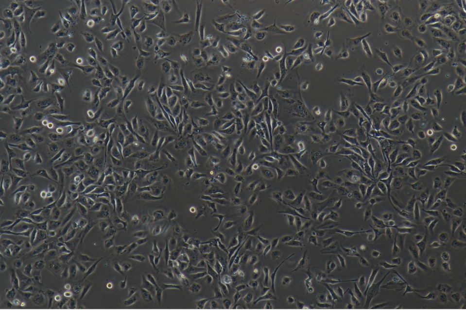 人牙龈成纤维细胞有限细胞系HGF1SV40T，ATCC来源