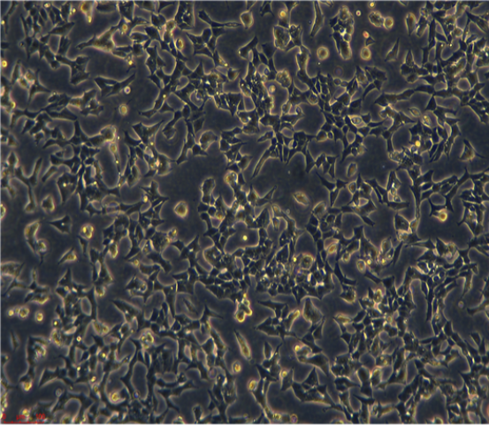 人印戒细胞胃腺癌SNU601，ATCC来源