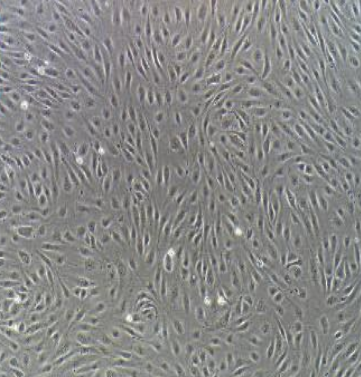 人喉鳞状细胞癌SNU1066，ATCC来源