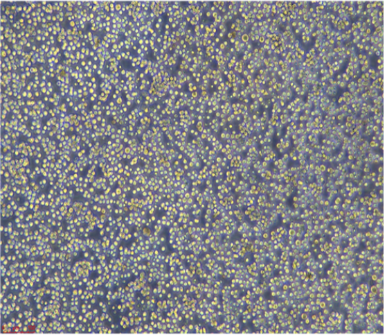 人乳腺癌细胞（三阴性）CAL51，ATCC来源