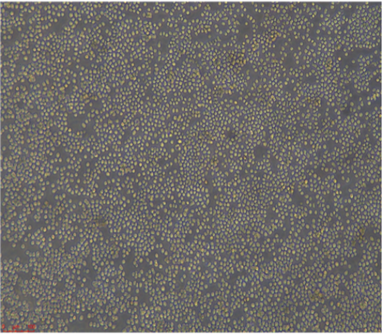 人直肠腺癌细胞SNU61，ATCC来源