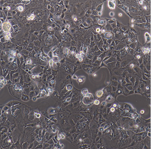 人卵巢癌细胞+耐顺铂SKOV3/ddp，ATCC来源