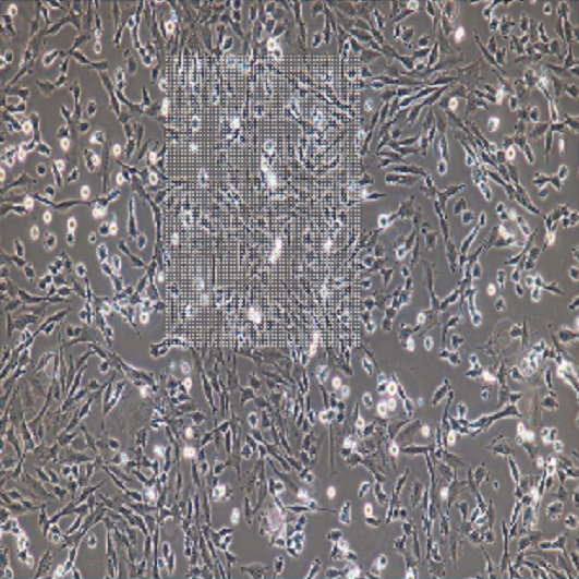 人甲状腺癌细胞未分化Ocut-2C?