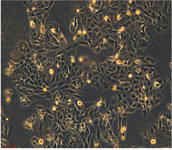 人肺鳞癌细胞HCC1588，ATCC细胞