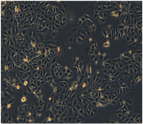 人卵巢浆液性囊腺癌细胞SHIN3，ATCC细胞