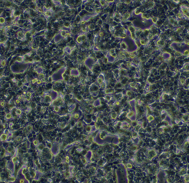 人纤维肉瘤细胞HT-1080+CXCR4(h)-Puro，ATCC细胞