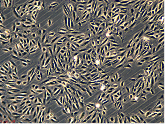 人印戒细胞胃腺癌SNU601/LUC(带荧光素酶)