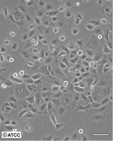 人乳腺癌细胞HCC1428/LUC(带荧光素酶)