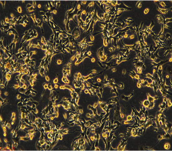 小鼠骨髓瘤细胞P3X63Ag8.653/LUC(带荧光素酶)