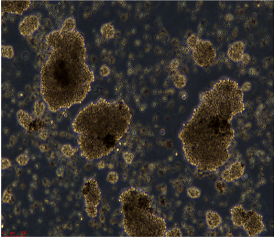 人印戒细胞胃腺癌SNU-601/LUC(带荧光素酶)