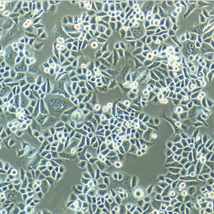 人乳腺癌细胞带绿色荧光MCF-7/GFP