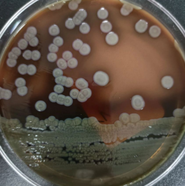 Mycotypha Microspora