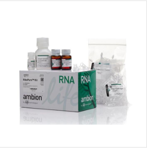 人免疫缺陷病毒1型M群H型染料法荧光定量RT-PCR试剂盒Human Immunodeficiency Virus 1(HIV-1M-H)