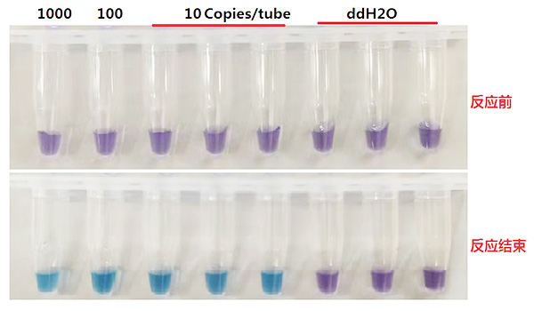 耶氏肺孢子虫染料法荧光定量PCR试剂盒Pneumocystis jirovecii 