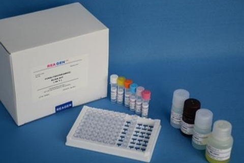 人腺病毒D87型探针法荧光定量PCR试剂盒Human Adenovirus D87（HAdV-D87）