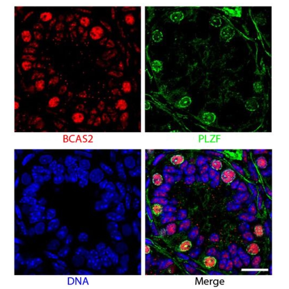 Southern Biotech 山羊抗小鼠 IgG（H+L）-HRP多克隆