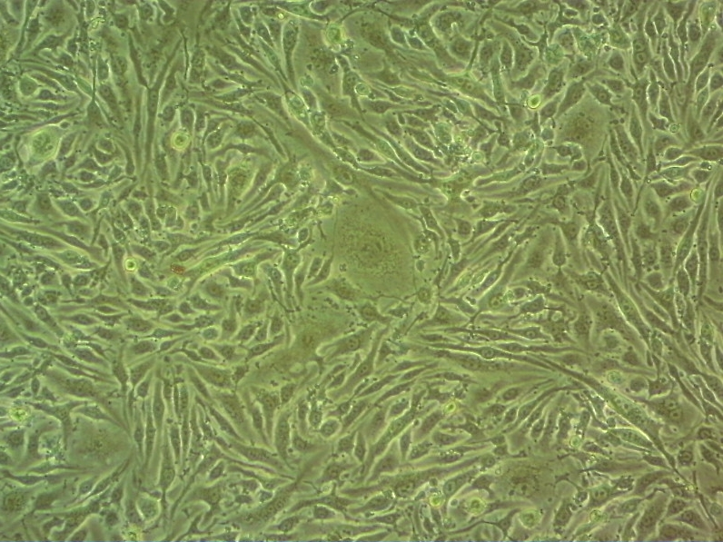 NCI-H841人小细胞肺癌