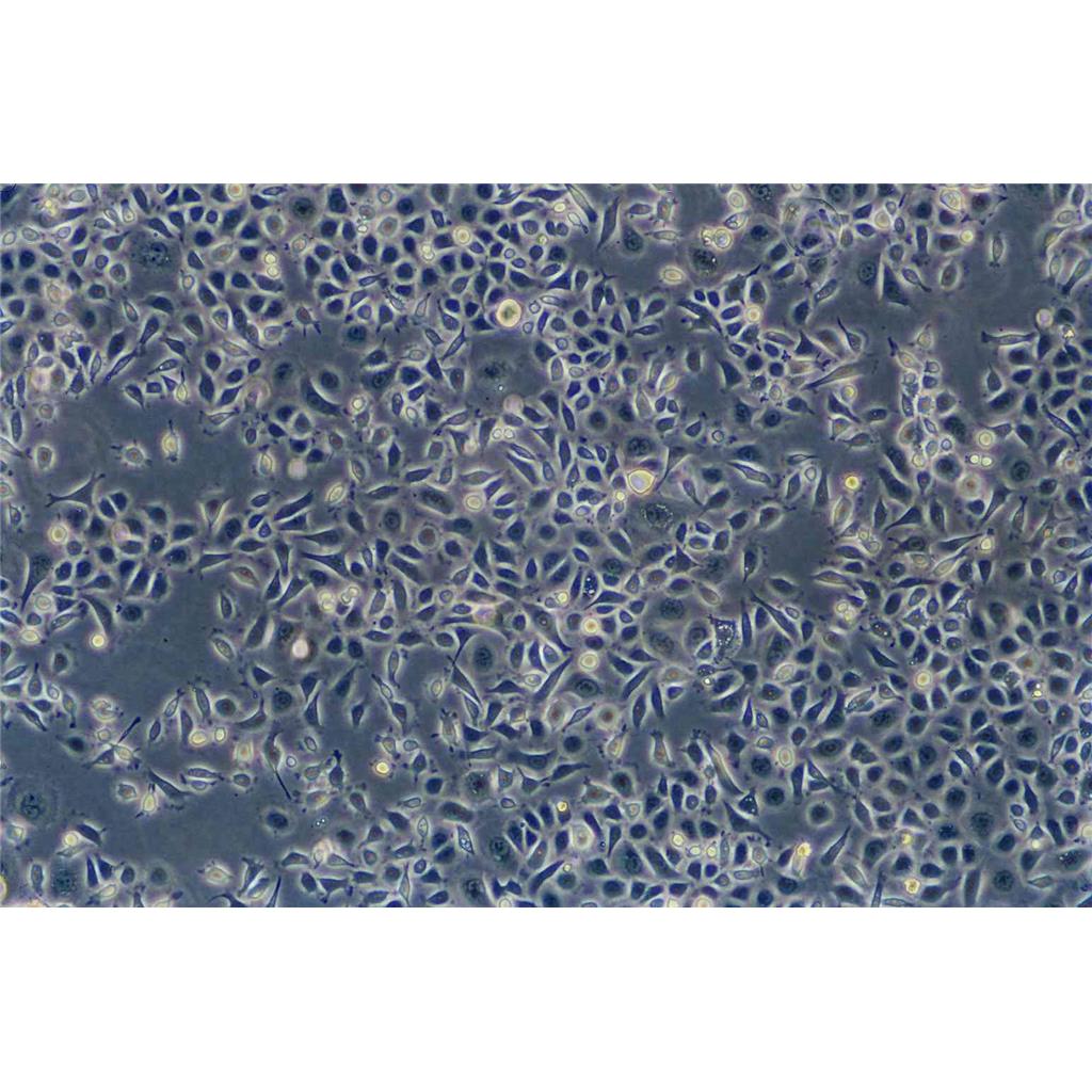 SW-13 Cells人肾上腺皮质小细胞癌细胞系(提供STR图谱)