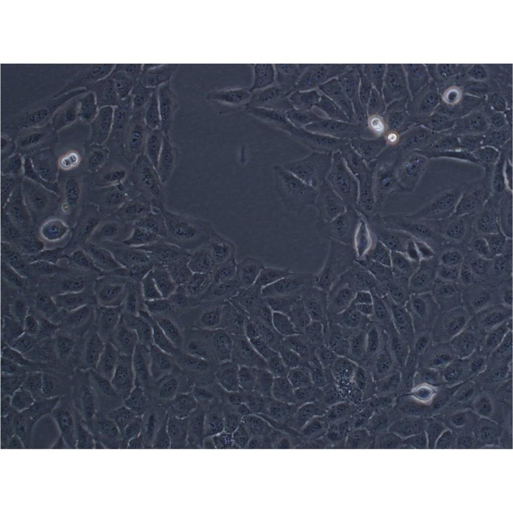 SW-13 Cells人肾上腺皮质小细胞癌细胞系(提供STR图谱)