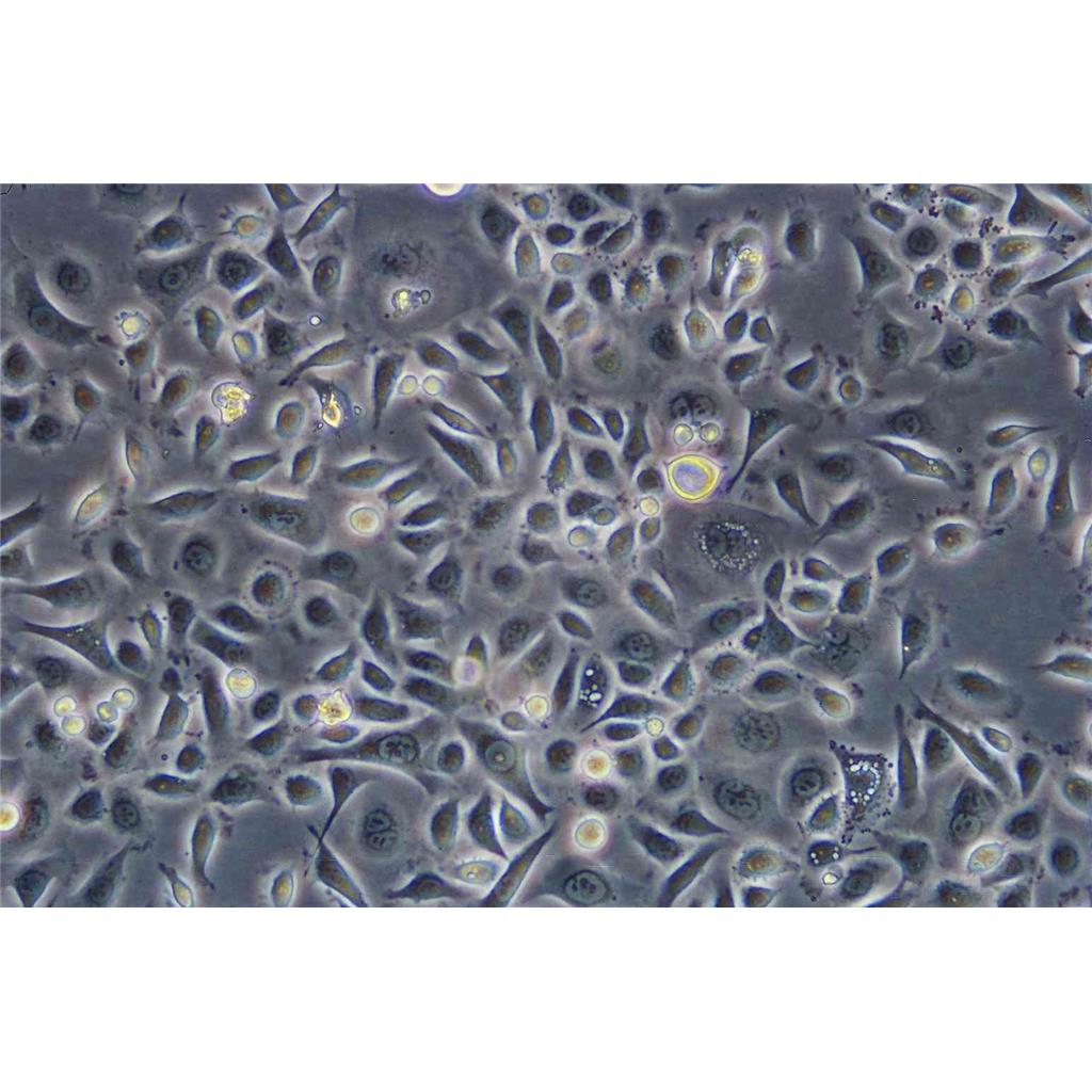 UM-UC-3 Cells人膀胱移行癌细胞系(提供STR图谱)