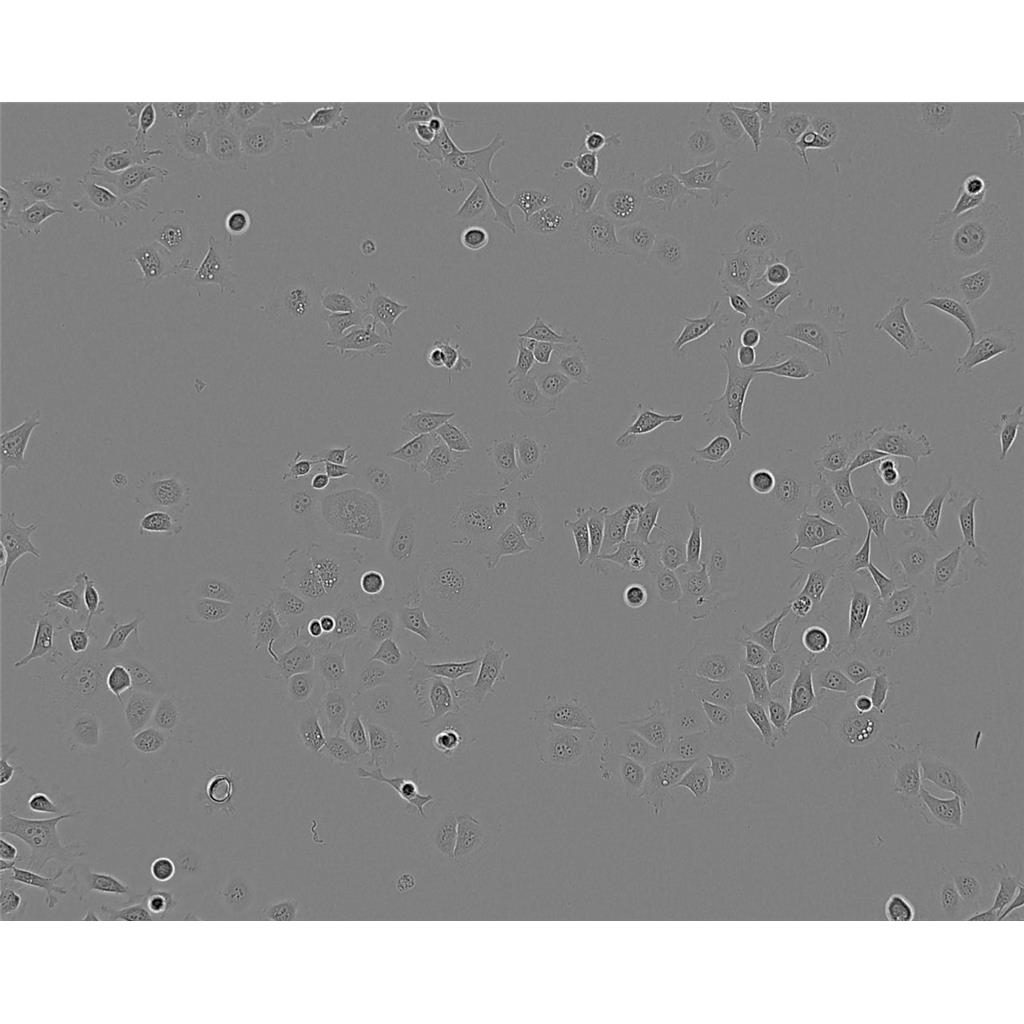 HMY-1 Cells人黑色素瘤细胞系(提供STR图谱)