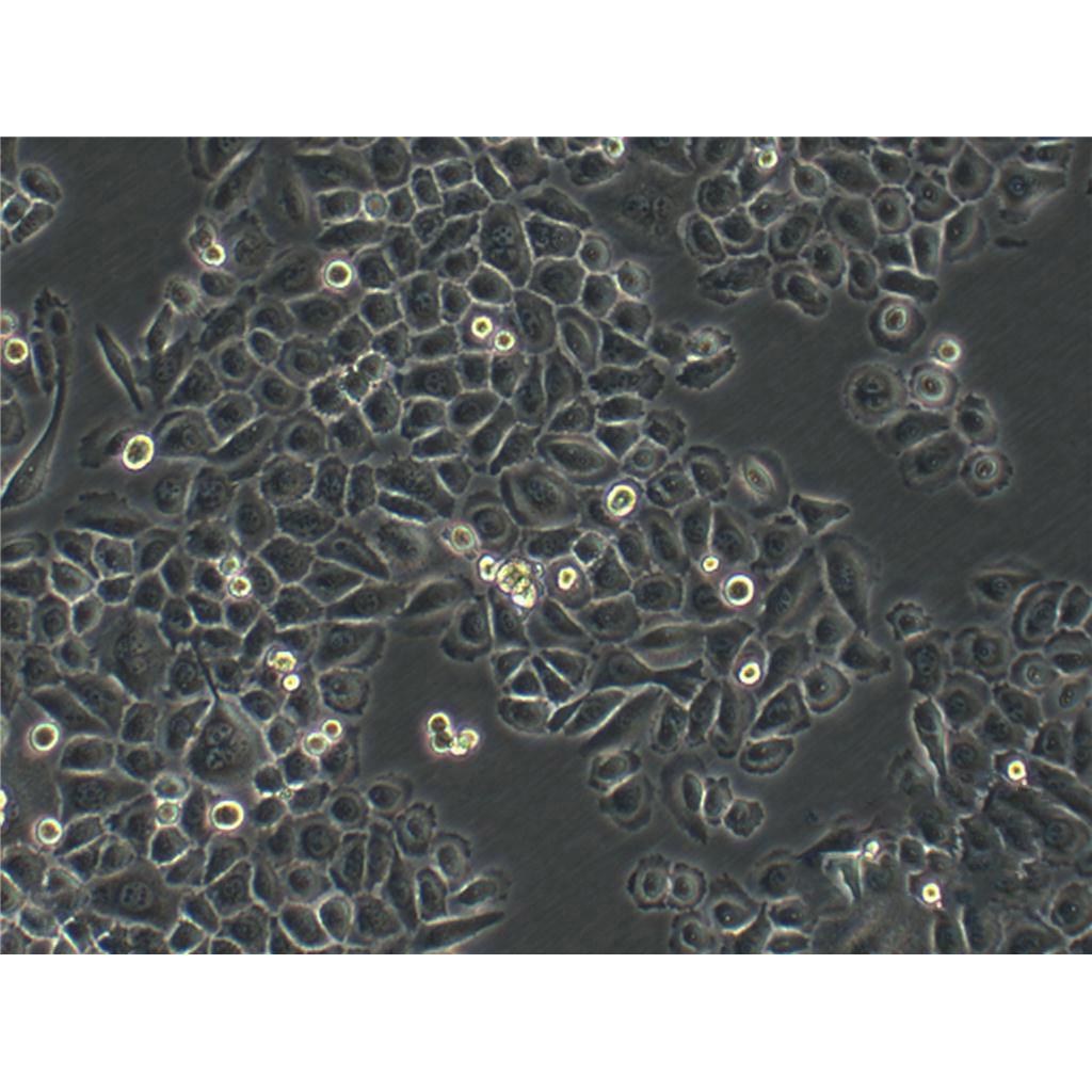 MDA-kb2 Cells人乳腺癌细胞系(提供STR图谱)