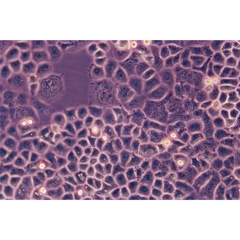 HCC1806 Cells人乳腺鳞状癌细胞系(提供STR图谱)